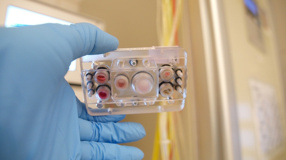 Hoffnung auf Ersatz für Tierversuche machen Forschern Multi-Organ-Chips, wie sie zum Beispiel an der TU Berlin entwickelt werden. Mäuse, Ratten, Affen, Fische, Schafe, Schweine, Katzen und Hunde werden in Tierversuchen eingesetzt. An ihnen werden Medikamente, Impfstoffe und Chemikalien getestet. Labortiere sind in der Medizin aber auch wichtig, um Therapien wie Organtransplantationen auszuprobieren. Tierschützer kritisieren, dass zu wenig an alternativen Methoden geforscht wird. | Bild: Alexandra Lorenz/TU Berlin Medizinische Biotechnologie /dpa Hoffnung auf Ersatz für Tierversuche machen Forschern Multi-Organ-Chips, wie sie zum Beispiel an der TU Berlin entwickelt werden. Mäuse, Ratten, Affen, Fische, Schafe, Schweine, Katzen und Hunde werden in Tierversuchen eingesetzt. An ihnen werden Medikamente, Impfstoffe und Chemikalien getestet. Labortiere sind in der Medizin aber auch wichtig, um Therapien wie Organtransplantationen auszuprobieren. Tierschützer kritisieren, dass zu wenig an alternativen Methoden geforscht wird. | Bild: Alexandra Lorenz/TU Berlin Medizinische Biotechnologie /dpa